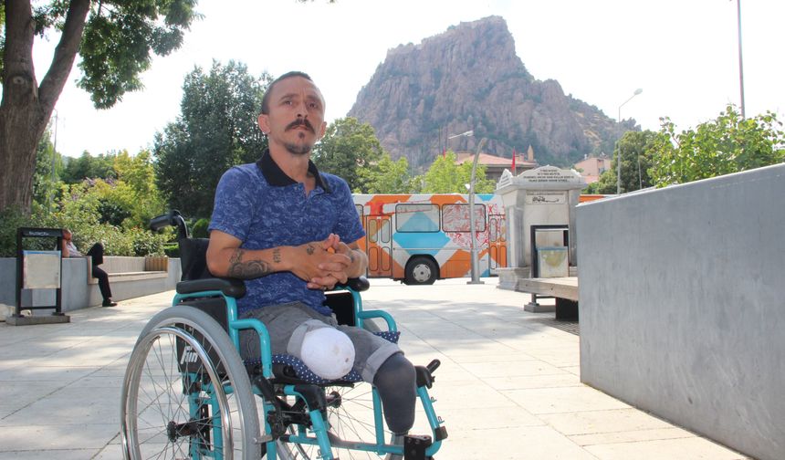Afyonlu tiyatro sanatçısı bir yılda iki bacağını birden kaybetti